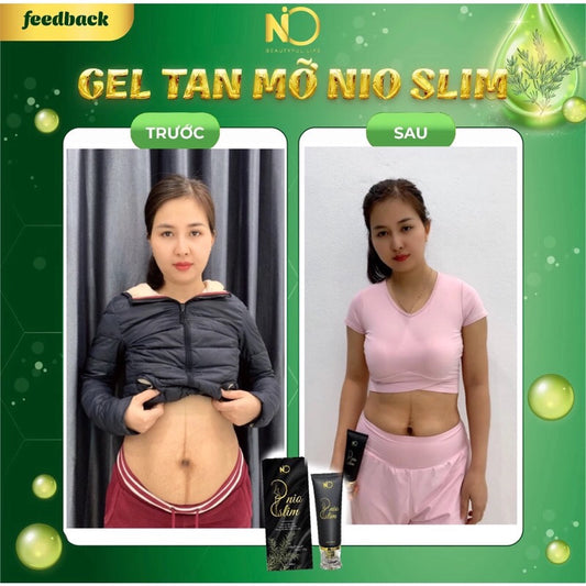 Gel tan mỡ bụng nioslim